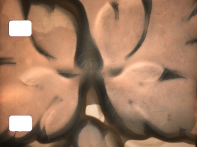 Phytography
